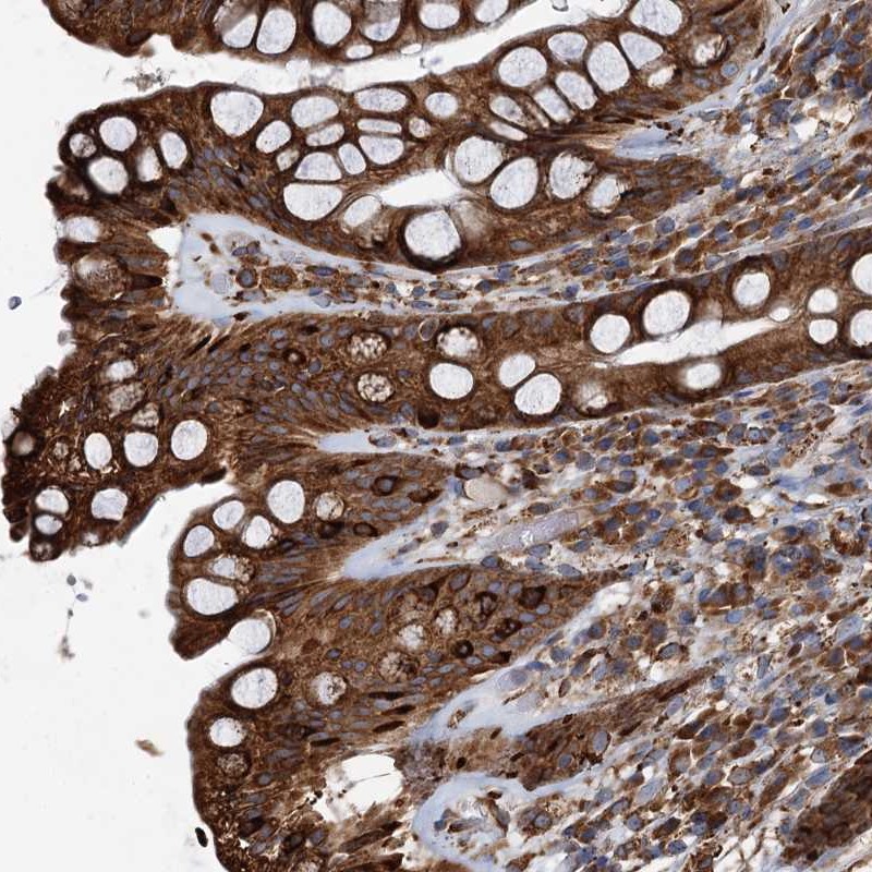 Atlas Antibodies Anti-NEURL1B Antibody