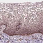 Atlas Antibodies Anti-NFAT5 Antibody