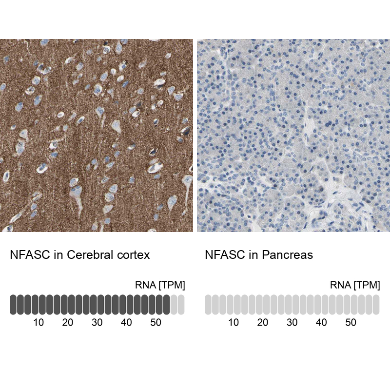 Atlas Antibodies Anti-NFASC Antibody