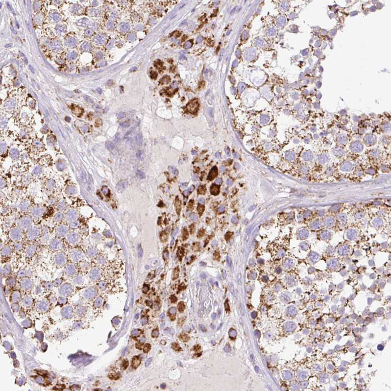 Atlas Antibodies Anti-NF1 Antibody