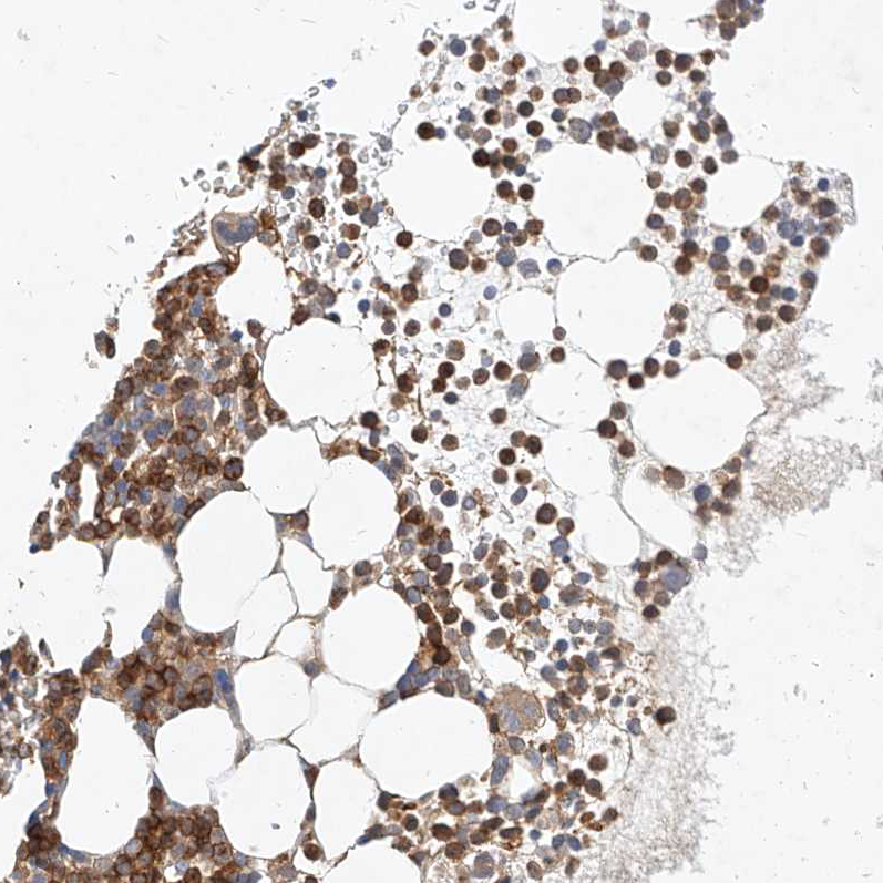 Atlas Antibodies Anti-NFAM1 Antibody