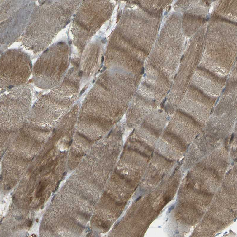 Atlas Antibodies Anti-NEXN Antibody