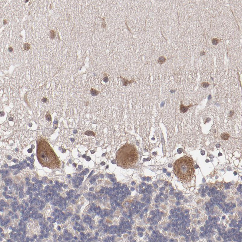 Atlas Antibodies Anti-NF2 Antibody