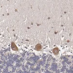 Atlas Antibodies Anti-NF2 Antibody