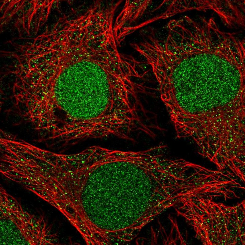 Atlas Antibodies Anti-NFATC2IP Antibody