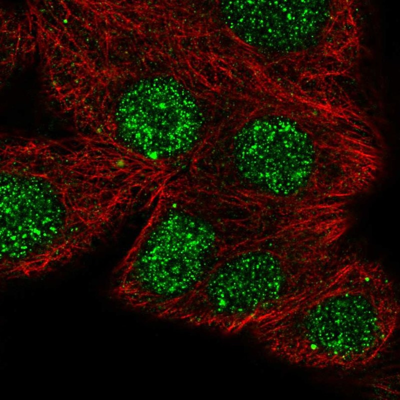 Atlas Antibodies Anti-NFATC1 Antibody
