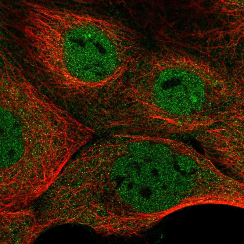 Atlas Antibodies Anti-NFATC3 Antibody