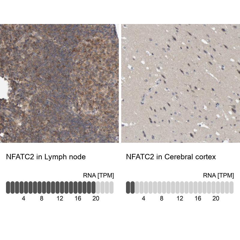 Atlas Antibodies Anti-NFATC2 Antibody