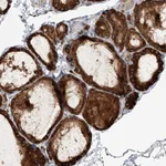 Atlas Antibodies Anti-NFATC4 Antibody