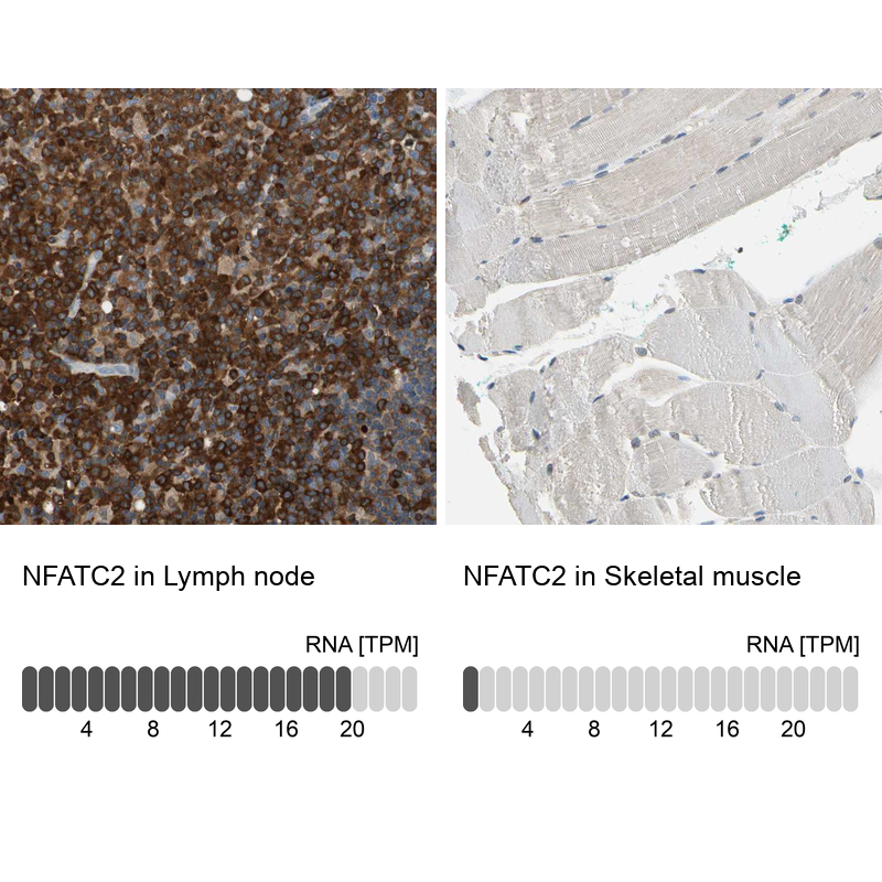 Atlas Antibodies Anti-NFATC2 Antibody