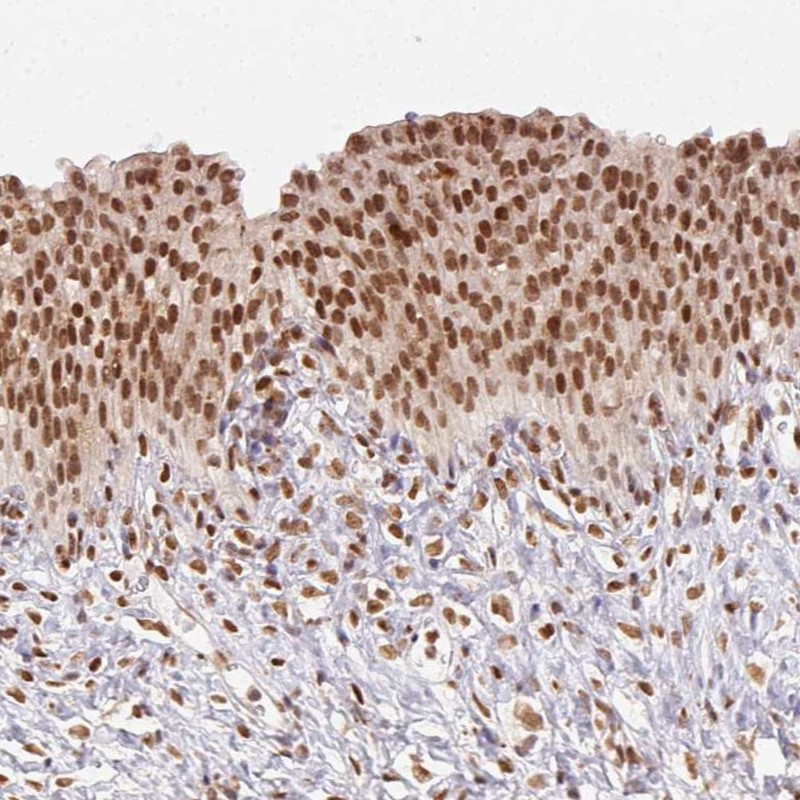 Atlas Antibodies Anti-NFE2L1 Antibody