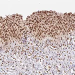 Atlas Antibodies Anti-NFE2L1 Antibody