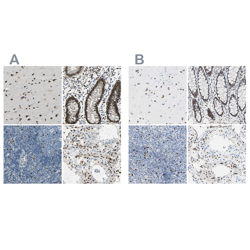 Atlas Antibodies Anti-NFIA Antibody