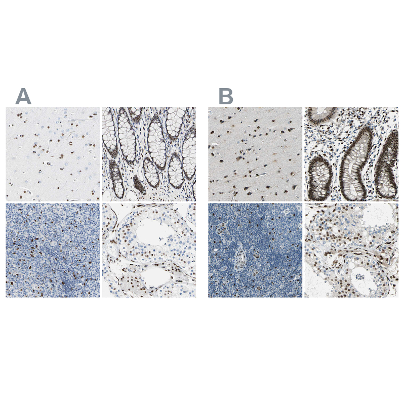 Atlas Antibodies Anti-NFIA Antibody