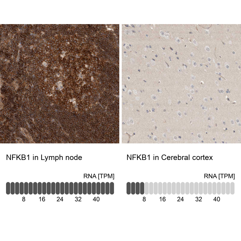 Atlas Antibodies Anti-NFKB1 Antibody