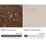 Atlas Antibodies Anti-NFKB1 Antibody