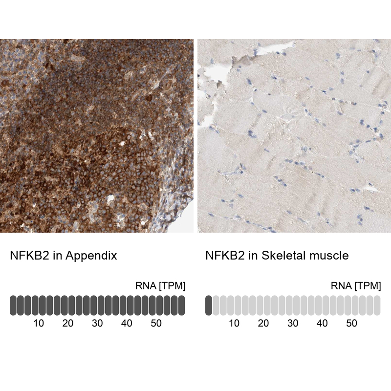 Atlas Antibodies Anti-NFKB2 Antibody