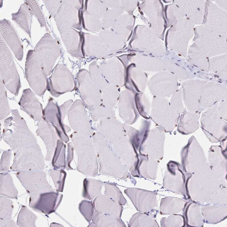 Atlas Antibodies Anti-NFIC Antibody