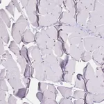 Atlas Antibodies Anti-NFIC Antibody