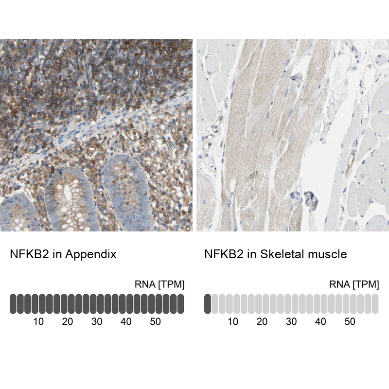 Atlas Antibodies Anti-NFKB2 Antibody