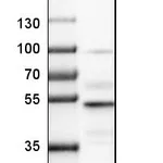 Atlas Antibodies Anti-NFIB Antibody
