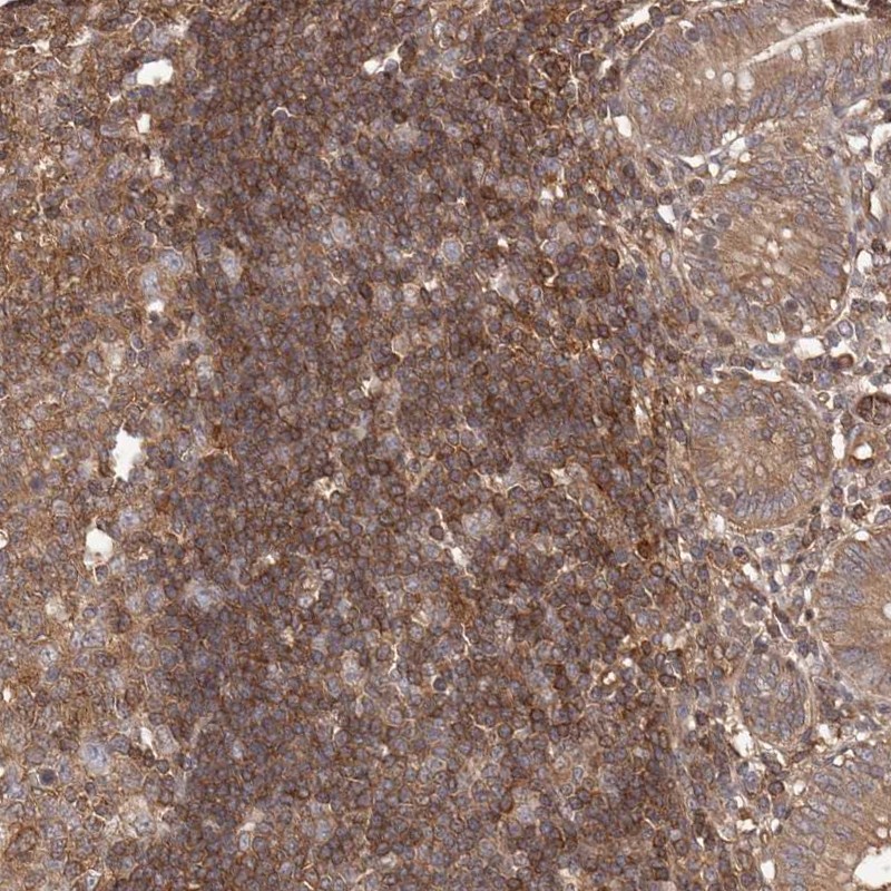 Atlas Antibodies Anti-NFKBIA Antibody
