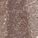 Atlas Antibodies Anti-NFKBIA Antibody