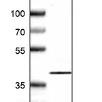Atlas Antibodies Anti-NFKBIB Antibody