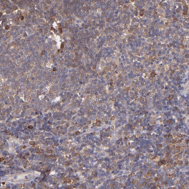 Atlas Antibodies Anti-NFKBIE Antibody
