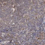 Atlas Antibodies Anti-NFKBIE Antibody