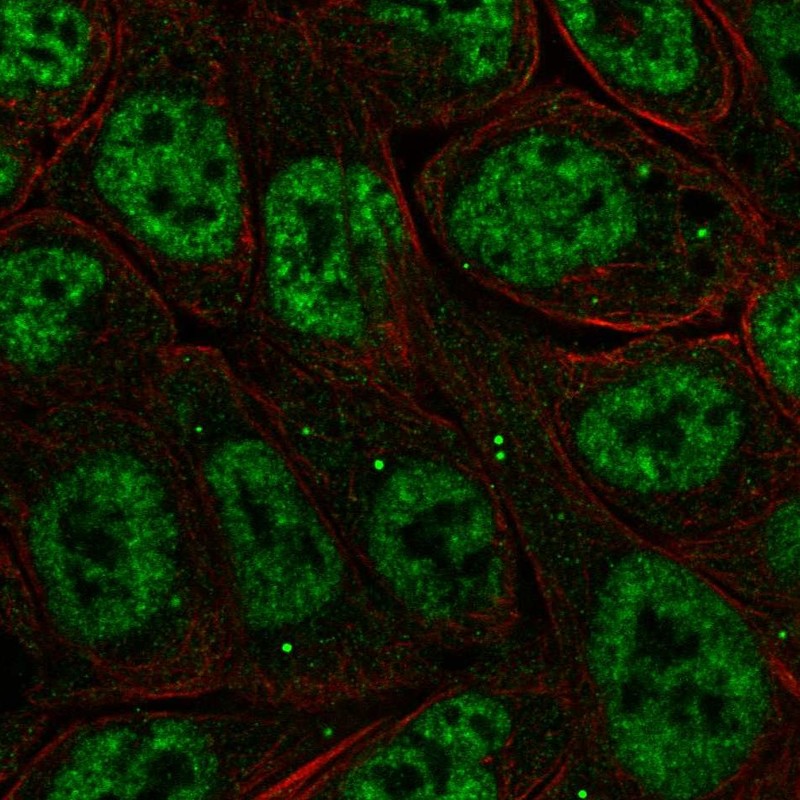 Atlas Antibodies Anti-NFKBIZ Antibody
