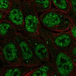 Atlas Antibodies Anti-NFKBIZ Antibody