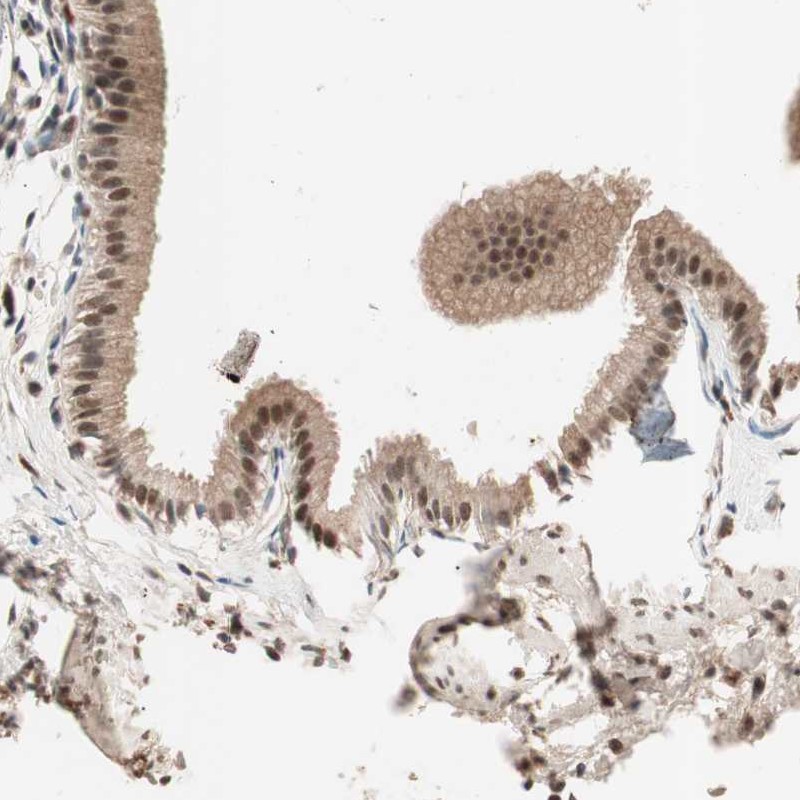 Atlas Antibodies Anti-NFRKB Antibody