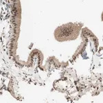 Atlas Antibodies Anti-NFRKB Antibody