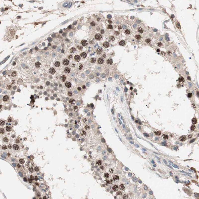 Atlas Antibodies Anti-NFRKB Antibody
