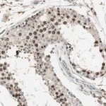 Atlas Antibodies Anti-NFRKB Antibody