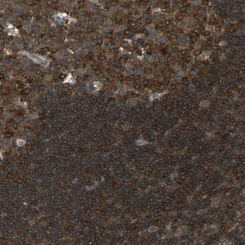 Atlas Antibodies Anti-NFKBIE Antibody