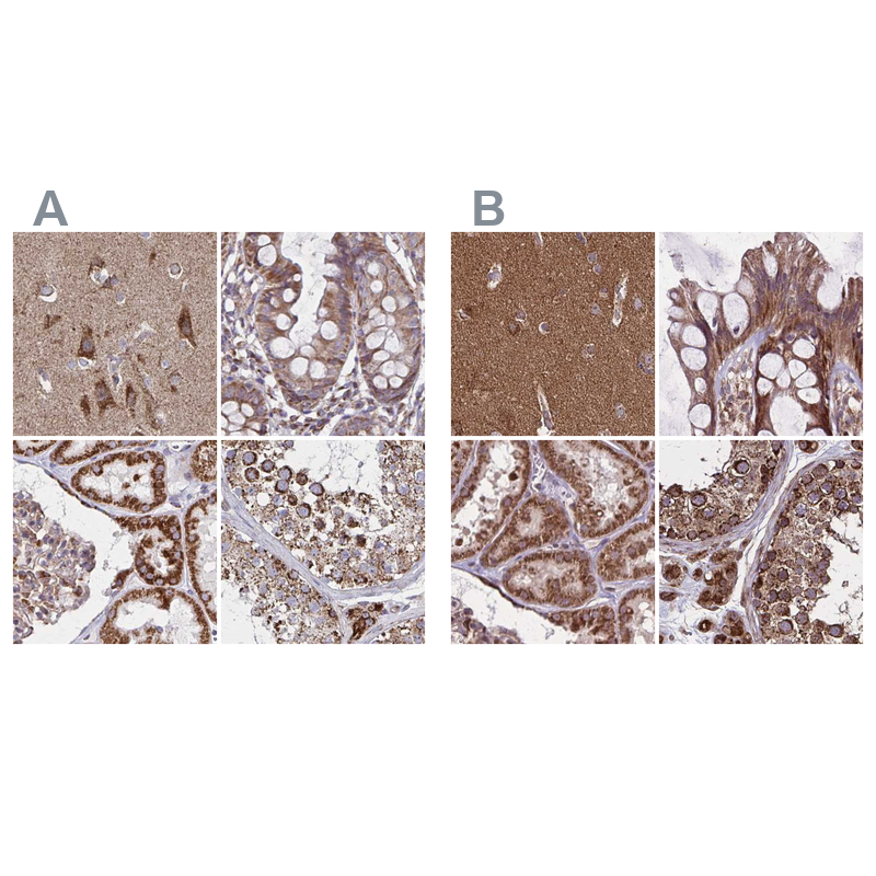 Atlas Antibodies Anti-NFS1 Antibody