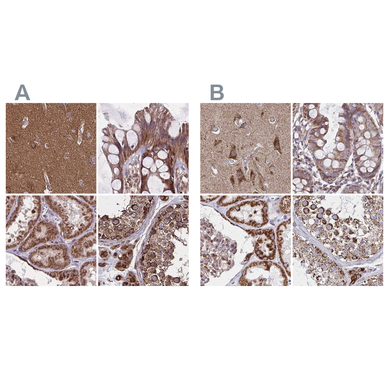 Atlas Antibodies Anti-NFS1 Antibody