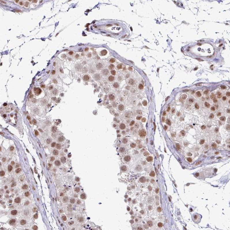 Atlas Antibodies Anti-NFYA Antibody