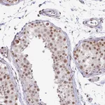 Atlas Antibodies Anti-NFYA Antibody