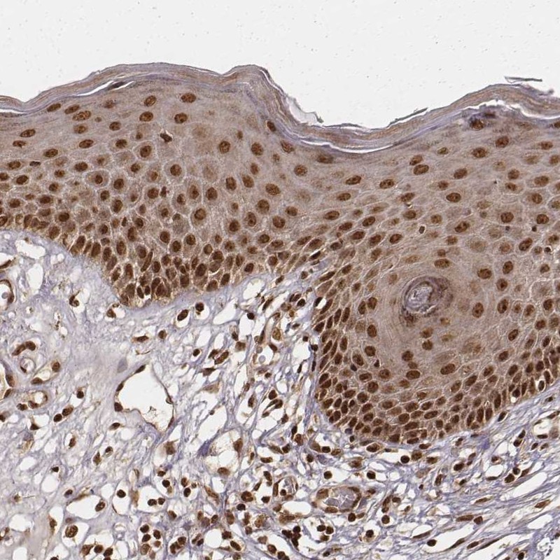 Atlas Antibodies Anti-NFX1 Antibody