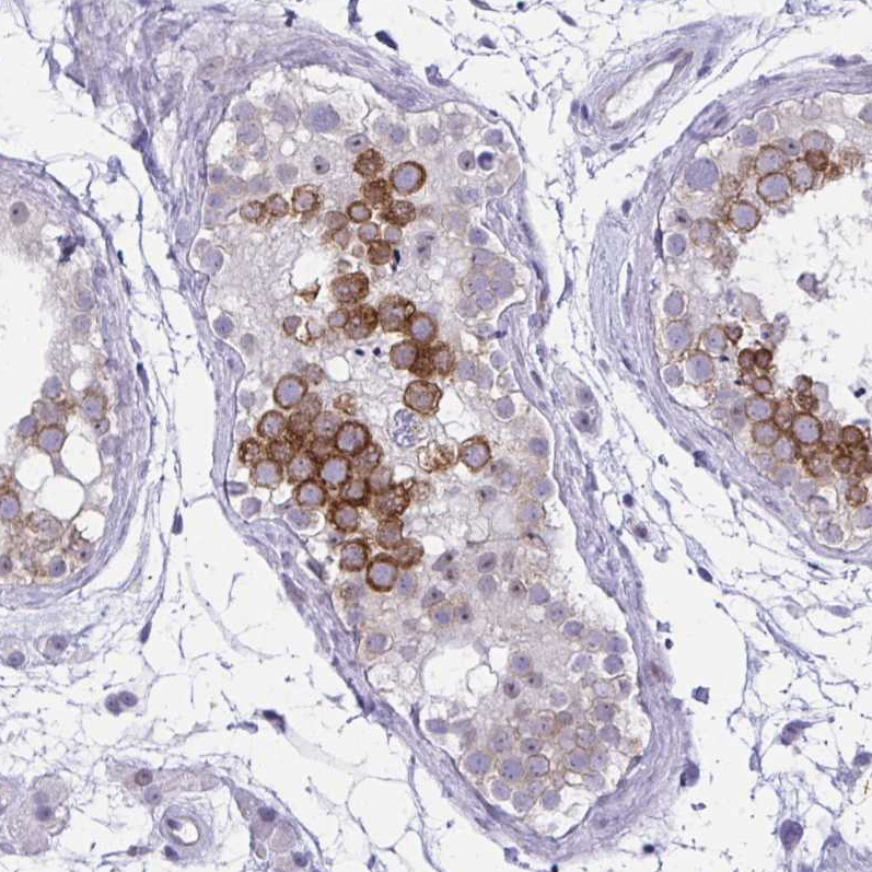 Atlas Antibodies Anti-NFXL1 Antibody