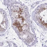 Atlas Antibodies Anti-NFXL1 Antibody