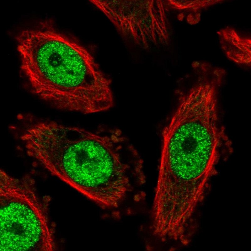 Atlas Antibodies Anti-NFYC Antibody