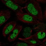 Atlas Antibodies Anti-NFYB Antibody