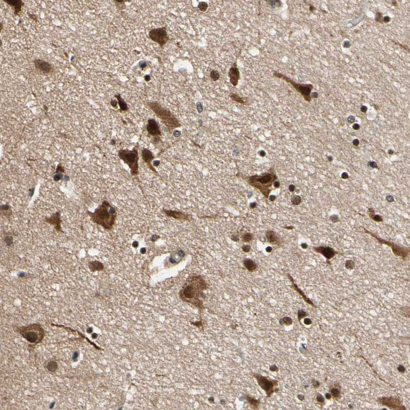 Atlas Antibodies Anti-NGEF Antibody