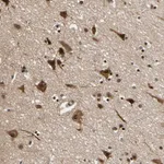 Atlas Antibodies Anti-NGEF Antibody