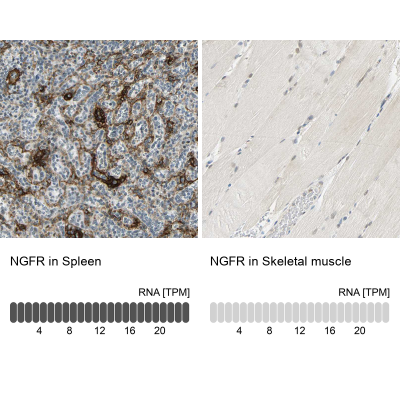 Atlas Antibodies Anti-NGFR Antibody