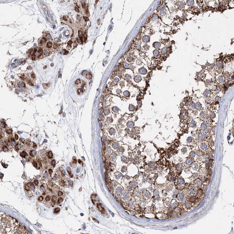 Atlas Antibodies Anti-NGLY1 Antibody